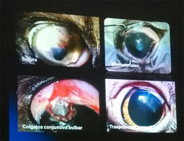 Patologías del Ojo